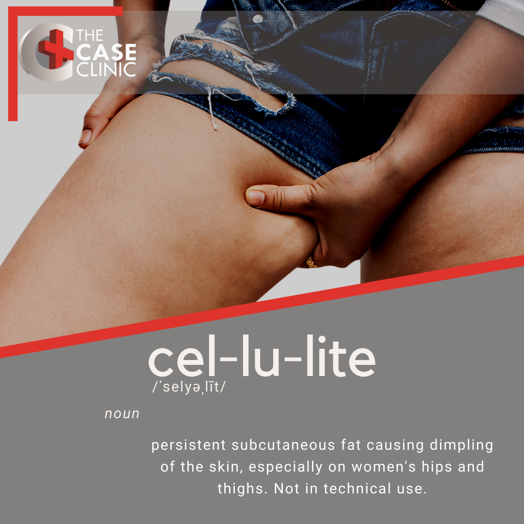 Cellulite Definition-IG